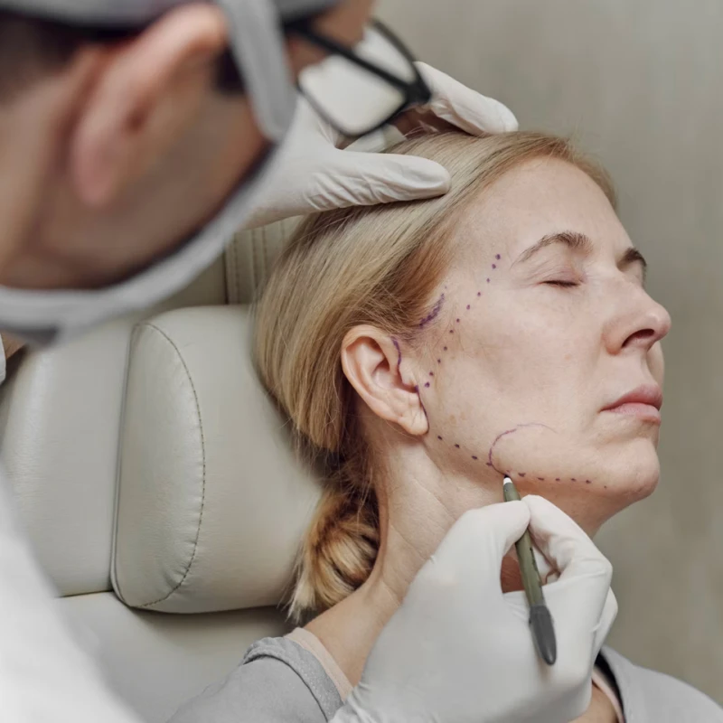 Wie lange hält das Ergebnis einer Gesichtsstraffung?