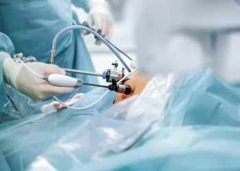 Laparoskopische Sleeve-Gastrektomie