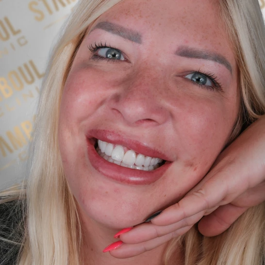 Porzellankronen Vorher-Nacher