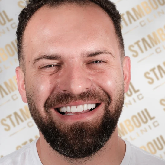 Zahnverblendungen Vorher-Nacher