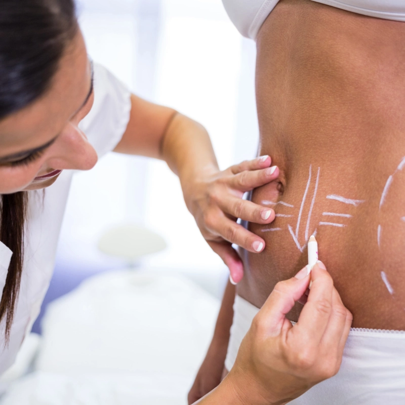 How Long Do Fat Injection Results Last?