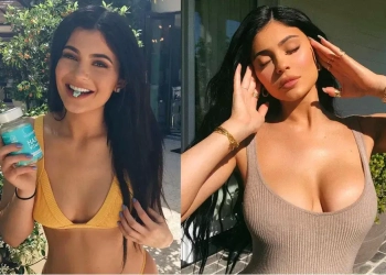 Kylie Jenner Brustvergrößerung: Alle Details zu ihrem exakten Boob-Job