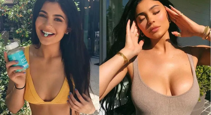 Kylie Jenner Breast Augmentation: Her Exact Boob Job Details