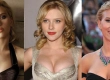 Scarlett Johansson Brustvergrößerung: Vorher Nachher