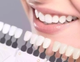 The Truth About Porcelain vs. Composite Veneers
