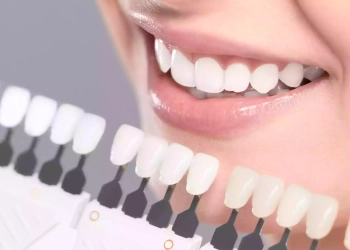 The Truth About Porcelain vs. Composite Veneers