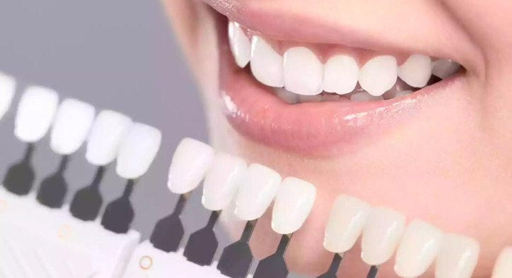 The Truth About Porcelain vs. Composite Veneers