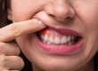 Zahnschmerzen am Zahnfleisch: Ursachen & Linderung