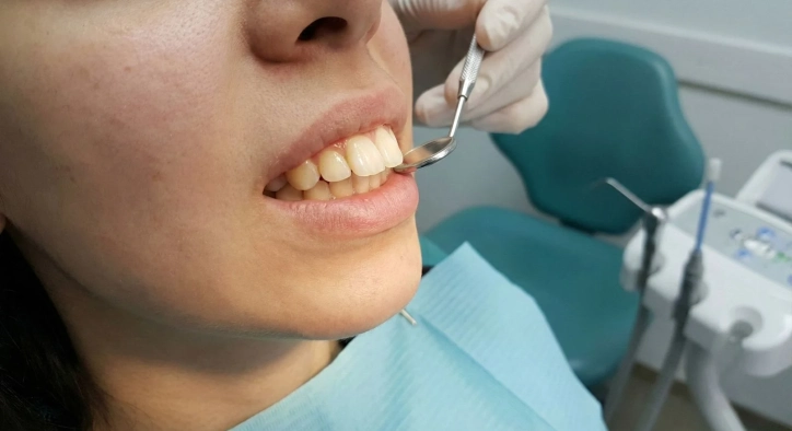 Buck Teeth Causes, Risks and Modern Correction Methods