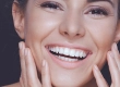 Hollywood-Lächeln Türkei: Maßgeschneidertes digitales Smile Makeover