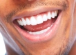 Teeth Shaping: The Ultimate Guide to Perfect Teeth Shapes and Facial Harmony