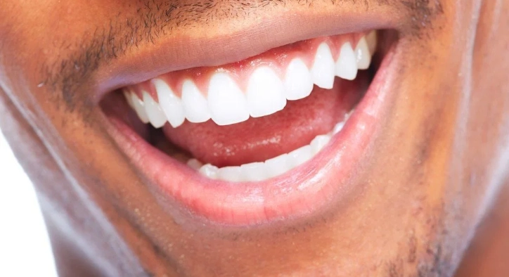 Teeth Shaping: The Ultimate Guide to Perfect Teeth Shapes and Facial Harmony
