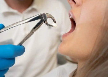 Having a Tooth Pulled: What to Expect, Recovery and Next Steps