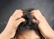 What Causes Itching After a Hair Transplant and How Can It Be Relieved?