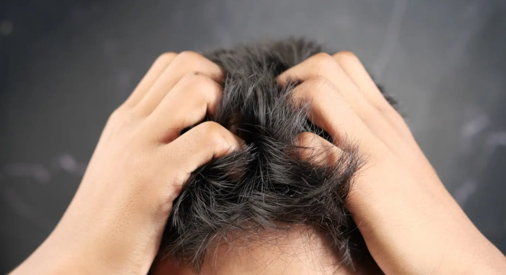 What Causes Itching After a Hair Transplant and How Can It Be Relieved?