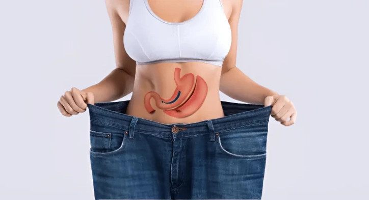 What Is Bariatric Surgery? Types, Costs, Risks & Weight Loss