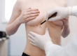 Breast Reduction and Lift: Turkey Costs, Recovery & Results