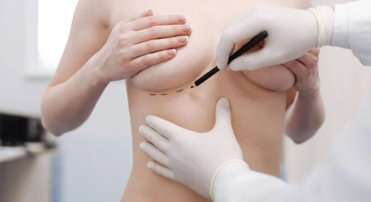 Breast Reduction and Lift: Turkey Costs, Recovery & Results