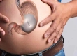 What Is Gastric Balloon? Turkey Costs, Procedures & Results