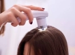 What Is Low-Level Laser Therapy for Hair Transplantation? How Is It Applied?