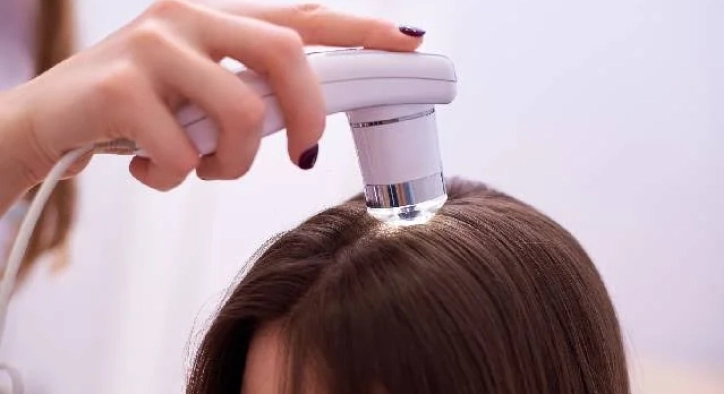 What Is Low-Level Laser Therapy for Hair Transplantation? How Is It Applied?