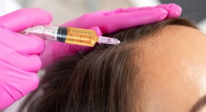 What Is Stem Cell Hair Transplantation? Procedure and Prices