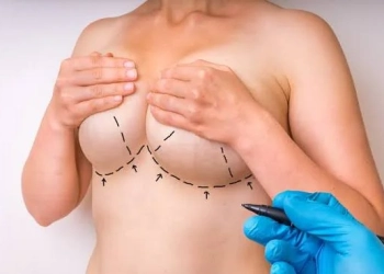 Breast Augmentation with Fat Transfer: Costs & Results