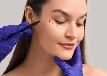 What Is Fox Eye Surgery? Lift Techniques, Results and Turkey Costs