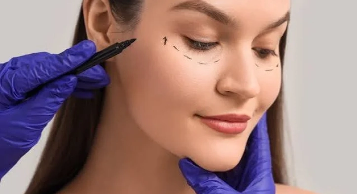 What Is Fox Eye Surgery? Lift Techniques, Results and Turkey Costs