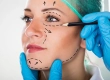 Midface Lift Endoscopic Surgery Costs, Results & Guide