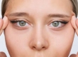 Canthoplasty Surgery: Turkey Costs, Almond Eyes & Scars