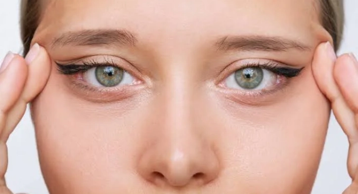 Canthoplasty Surgery: Turkey Costs, Almond Eyes & Scars