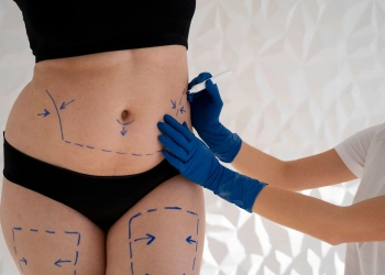 Gastric Botox: Turkey Costs, Reviews & Procedure Guide