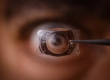 ICL Surgery: Turkey Costs, Safety, Flying & Candidacy