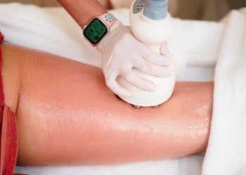 Cellulite Treatment: Laser, Subcision & Cost